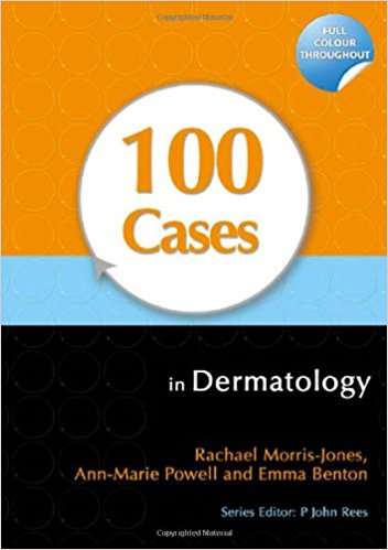 free-pdf-download-100 Cases in Dermatology 1st Edition