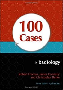 free-pdf-download-100 Cases in Radiology 1st Edition