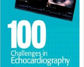 free-pdf-download-100 Challenges in Echocardiography