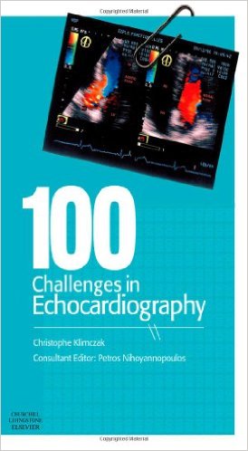 free-pdf-download-100 Challenges in Echocardiography