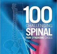 free-pdf-download-100 Challenging Spinal Pain Syndrome Cases