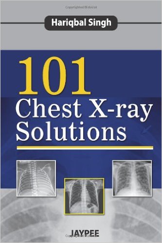 free-pdf-download-101 Chest X-ray Solutions 1st Edition