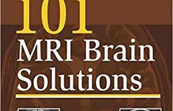 free-pdf-download-101 MRI Brain Solutions 1st Edition