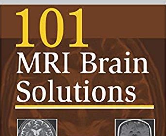 free-pdf-download-101 MRI Brain Solutions 1st Edition