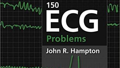 free-pdf-download-150 ECG Problems