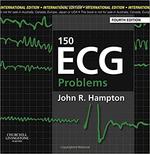 free-pdf-download-150 ECG Problems