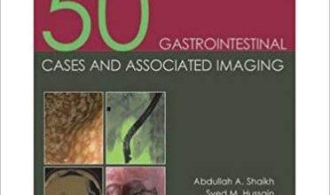 free-pdf-download-50 Gastrointestinal Cases & Associated Imaging