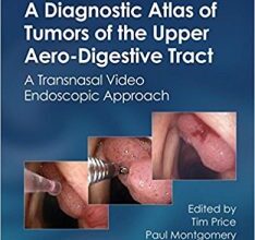 free-pdf-download-A Diagnostic Atlas of Tumors of the Upper Aero-Digestive Tract: A Transnasal Video Endoscopic Approach 1st Edition