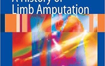 free-pdf-download-A History of Limb Amputation