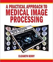 free-pdf-download-A Practical Approach to Medical Image Processing (Series in Medical Physics and Biomedical Engineering)