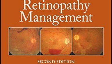 free-pdf-download-A Practical Manual of Diabetic Retinopathy Management (Practical Manual of Series) 2nd Edition