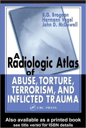 free-pdf-download-A Radiologic Atlas of Abuse