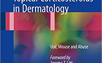 free-pdf-download-A Treatise on Topical Corticosteroids in Dermatology: Use