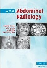 free-pdf-download-A-Z of Abdominal Radiology (A-Z (Cambridge University Press)) 1st Edition