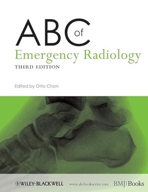 free-pdf-download-ABC of Emergency Radiology (ABC Series) 3rd Edition