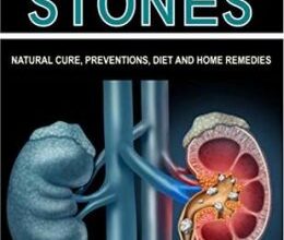 free-pdf-download-ALL YOU NEED TO KNOW ABOUT KIDNEY STONES: Natural Cure