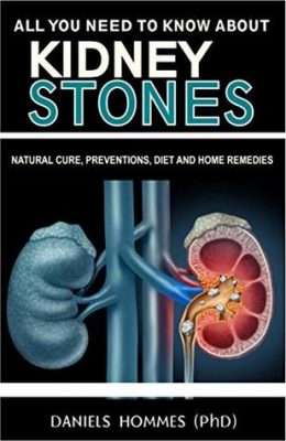 free-pdf-download-ALL YOU NEED TO KNOW ABOUT KIDNEY STONES: Natural Cure