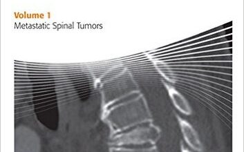 free-pdf-download-AOSpine Masters Series Volume 1: Metastatic Spinal Tumors (Aospine Master Series) 1st Edition