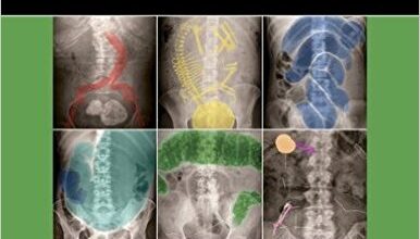 free-pdf-download-Abdominal X-rays for Medical Students 1st Edition