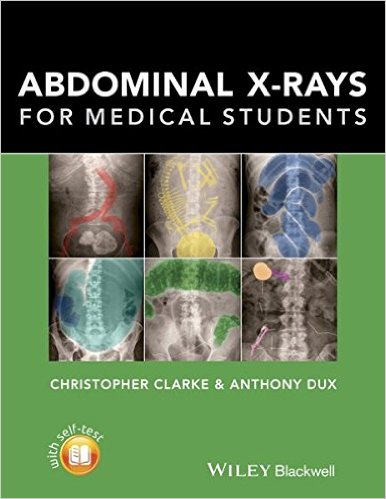 free-pdf-download-Abdominal X-rays for Medical Students 1st Edition