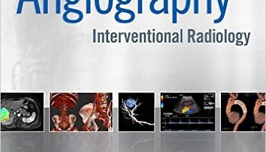 free-pdf-download-Abrams Angiography: Interventional Radiology 3rd edition