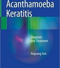 free-pdf-download-Acanthamoeba Keratitis: Diagnosis and Treatment 1st ed. 2018 Edition