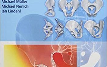 free-pdf-download-Acetabular Fractures: Diagnosis