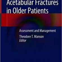 free-pdf-download-Acetabular Fractures in Older Patients: Assessment and Management