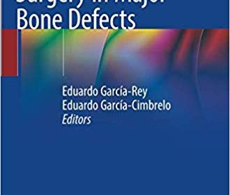 free-pdf-download-Acetabular Revision Surgery in Major Bone Defects