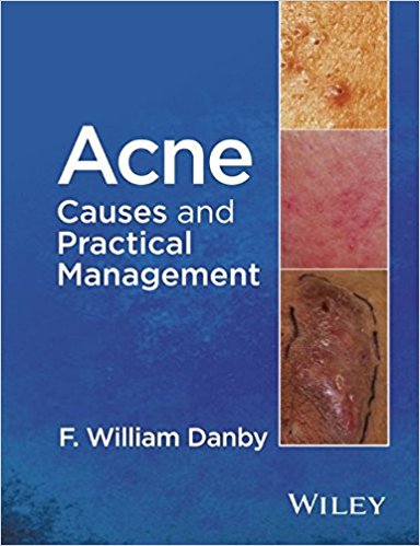 free-pdf-download-Acne: Causes and Practical Management 1st Edition