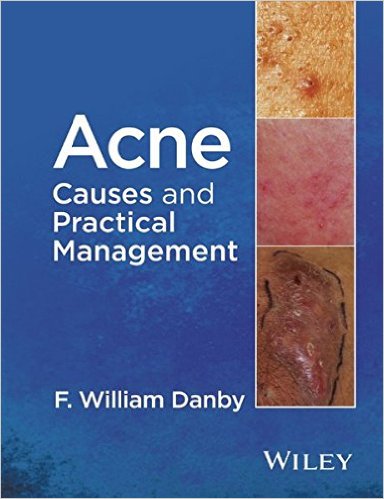 free-pdf-download-Acne: Causes and Practical Management