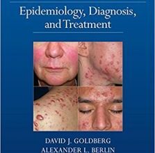 free-pdf-download-Acne and Rosacea: Epidemiology