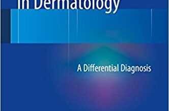 free-pdf-download-Acneiform Eruptions in Dermatology: A Differential Diagnosis 2014th Edition