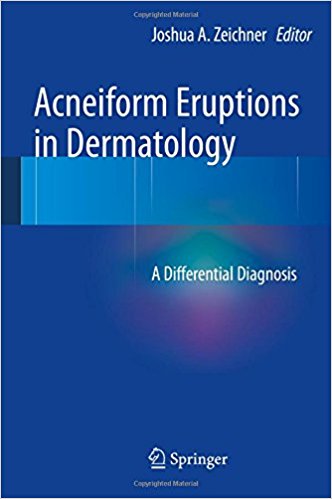 free-pdf-download-Acneiform Eruptions in Dermatology: A Differential Diagnosis 2014th Edition