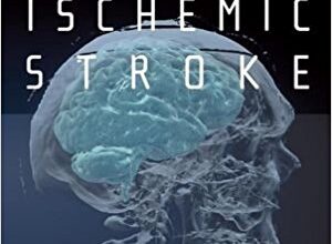 free-pdf-download-Acute Ischemic Stroke: An Evidence-based Approach 1st Edition