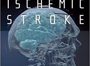 free-pdf-download-Acute Ischemic Stroke: An Evidence-based Approach 1st Edition