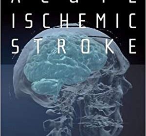 free-pdf-download-Acute Ischemic Stroke: An Evidence-based Approach 1st Edition