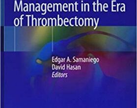 free-pdf-download-Acute Stroke Management in the Era of Thrombectomy