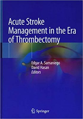 free-pdf-download-Acute Stroke Management in the Era of Thrombectomy