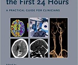 free-pdf-download-Acute Stroke Management in the First 24 Hours: A Practical Guide for Clinicians