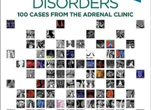 free-pdf-download-Adrenal Disorders: 100 Cases from the Adrenal Clinic 1st Edition