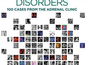 free-pdf-download-Adrenal Disorders: 100 Cases from the Adrenal Clinic