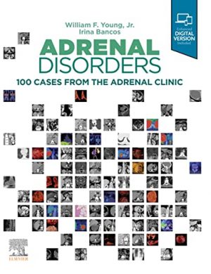 free-pdf-download-Adrenal Disorders: 100 Cases from the Adrenal Clinic