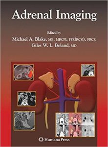 free-pdf-download-Adrenal Imaging (Contemporary Medical Imaging)