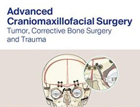 free-pdf-download-Advanced Craniomaxillofacial Surgery: Tumor