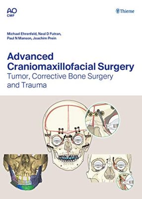 free-pdf-download-Advanced Craniomaxillofacial Surgery: Tumor