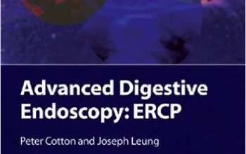 free-pdf-download-Advanced Digestive Endoscopy: ERCP 1st Edition