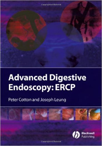 free-pdf-download-Advanced Digestive Endoscopy: ERCP 1st Edition