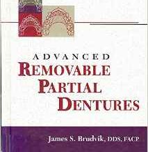 free-pdf-download-Advanced Removable Partial Dentures