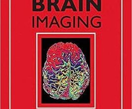 free-pdf-download-Advances in Brain Imaging (Review of Psychiatry) 1st Edition